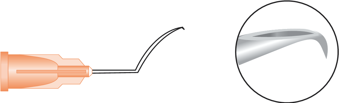 Long Cystotome Formed